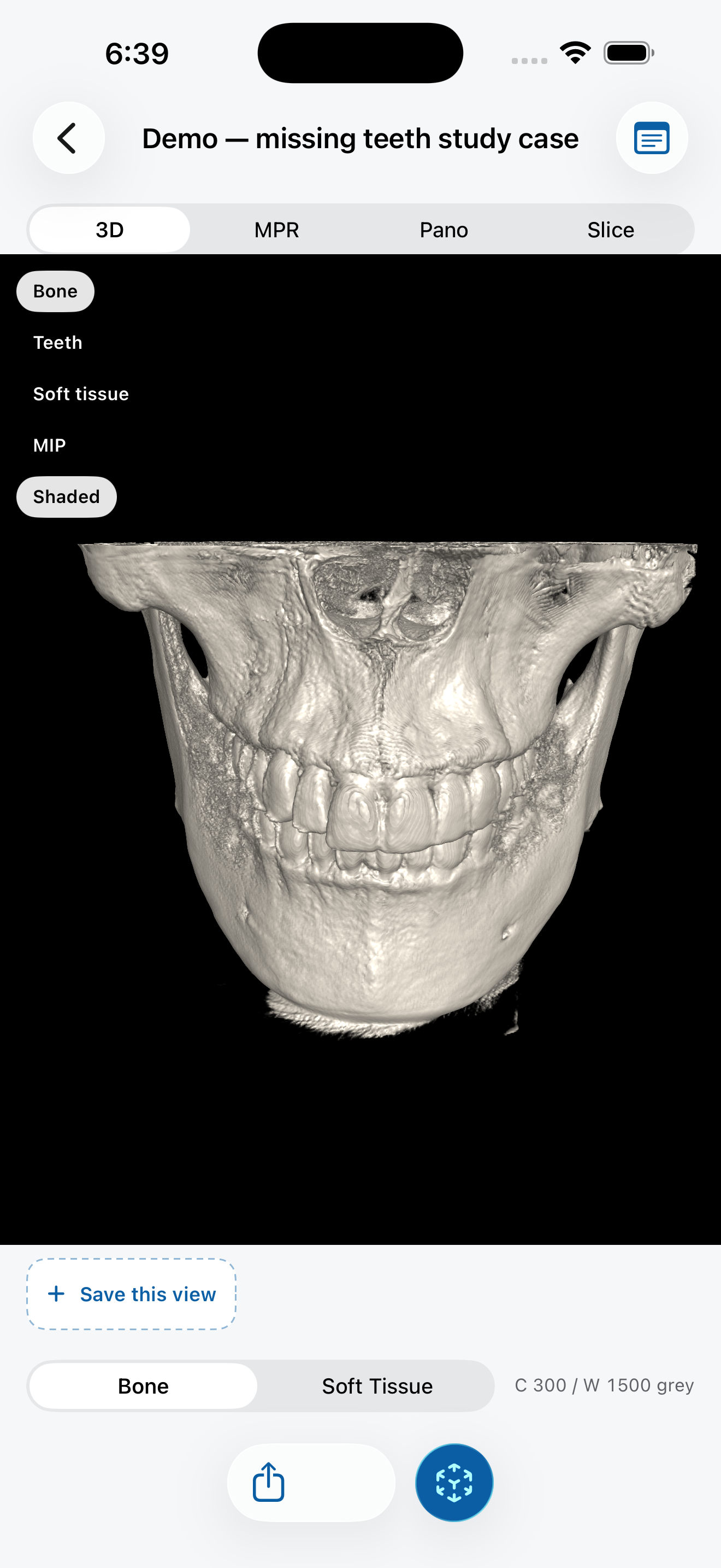 3D volume rendering