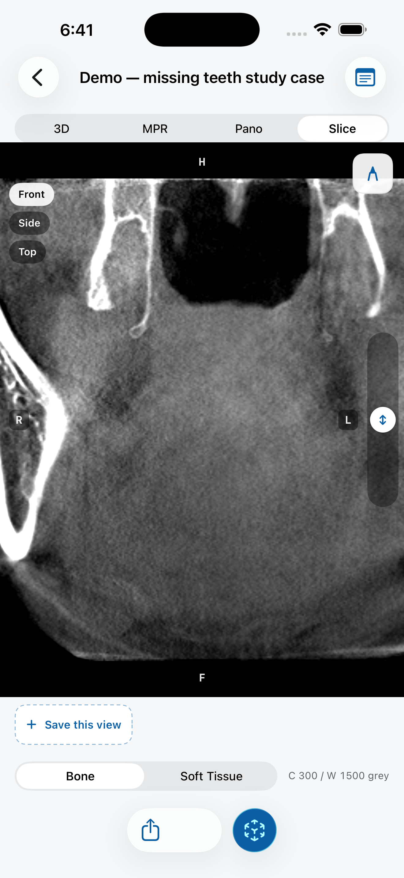 Single slice view